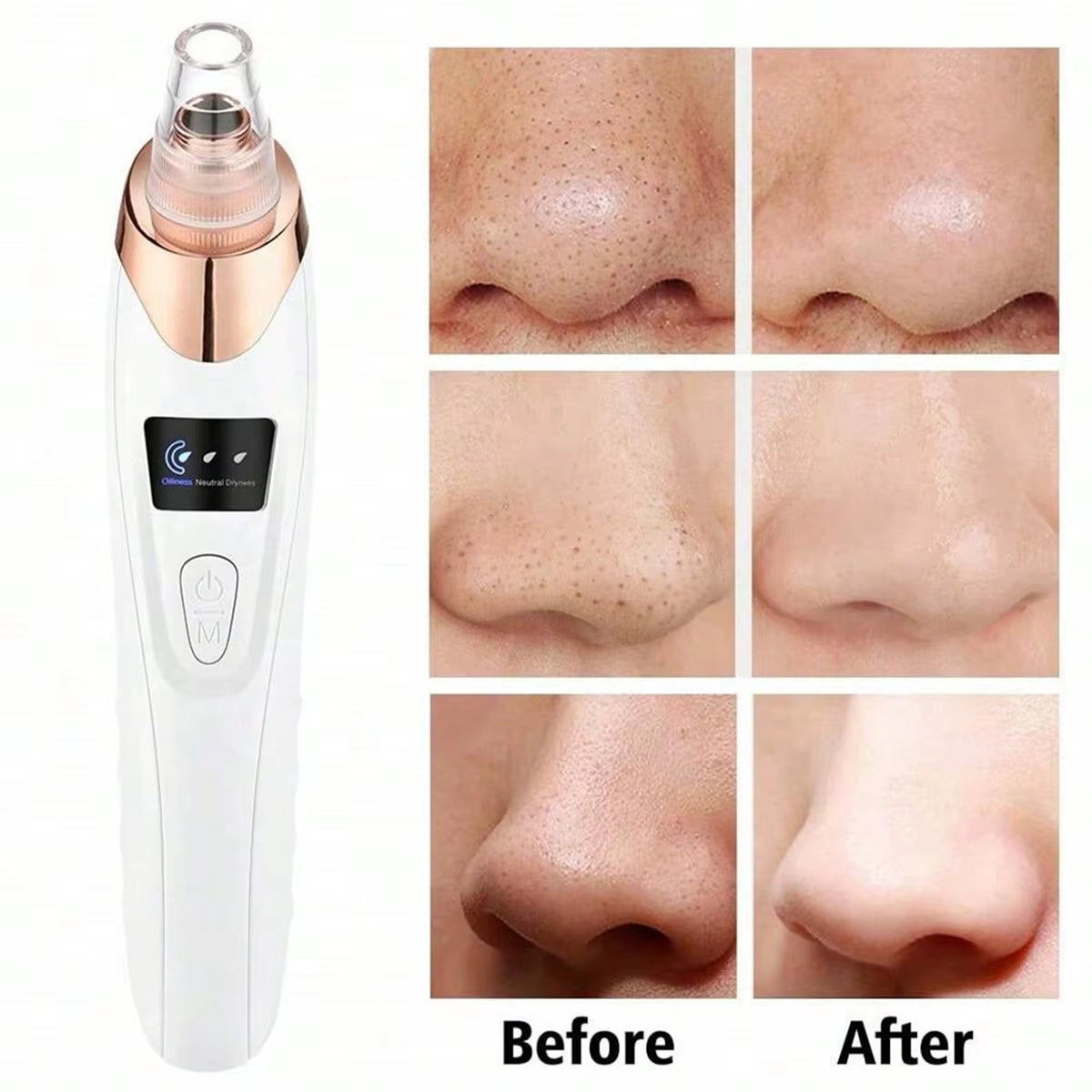 2026 Facial Pore Cleaner, 5 Suction Power Blackhead Remover Pore Vacuum - USB Rechargeable Facial Pore Cleaner Kit