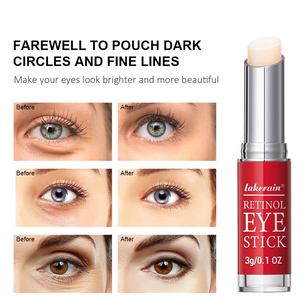 Revitalize Your Eyes with Our Retinol Eye Cream Stick - Brighten Dark Circles, Firm Skin, and Reduce Puffiness!