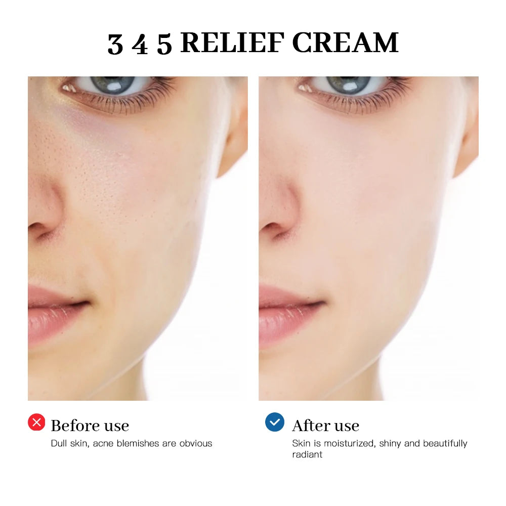 345 Relief Cream - Your Comprehensive Solution for Brightening Skin, Reducing Acne Marks, and Nourishing Moisture