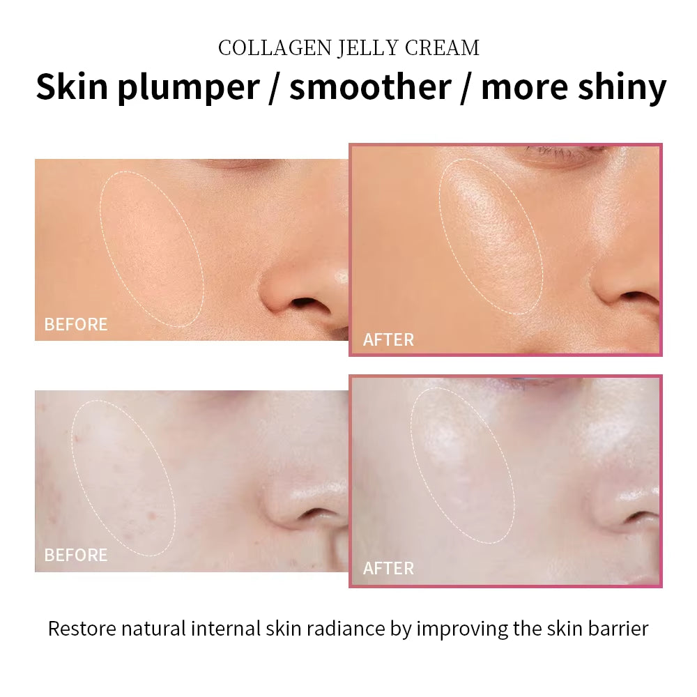 Moisturizing Collagen Jelly Cream Niacinamide Hydrolyzed Collagen Tightening Soothing Firmness Hydration Skincare